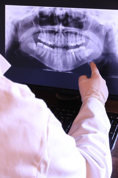 Best Emergency Dentist for Knocked-Out Tooth in Douglas, MI